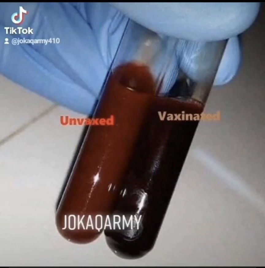 Vaxxed versus Unvaxxed blood